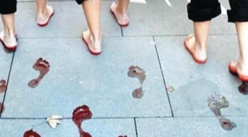 ‘Anne lütfen ölme!’ ‘Ölmek istemiyorum kızım!’