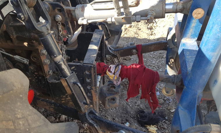 Saçları makineye sıkışan 17 yaşındaki işçi ağır yaralandı