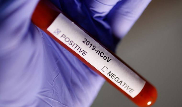 Koronavirüs Rusya'ya da sıçradı