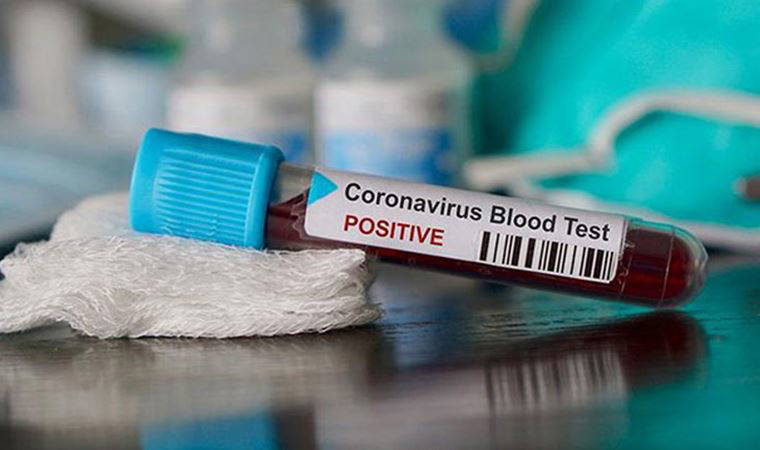 DSÖ, Covid-19'un yeni merkez üssünü açıkladı