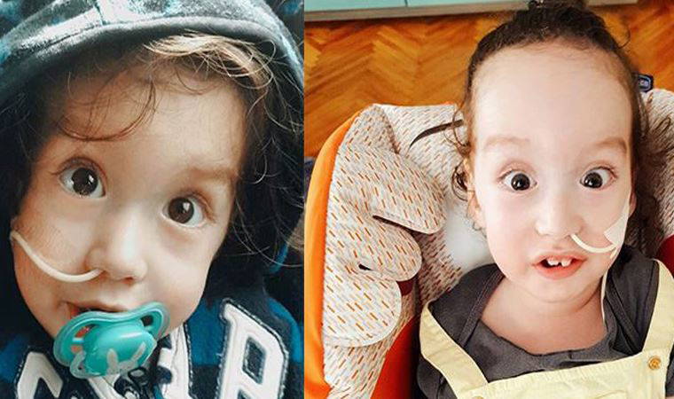 Üç büyükler SMA hastası Pamir bebek için buluştu: Yaşama tutunması için kritik günler