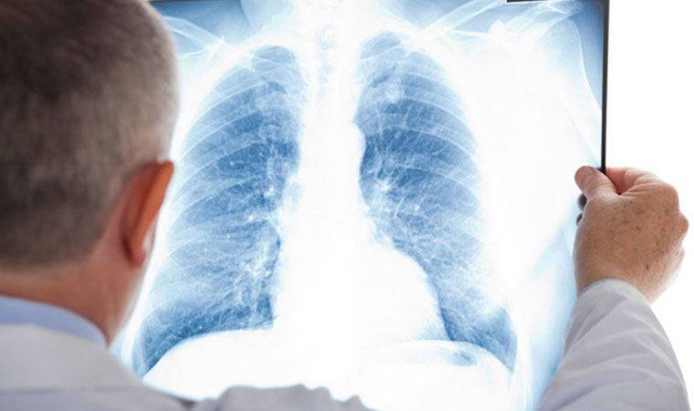 Uzman anlattı: Zatürreden korunmanın yolları nelerdir?