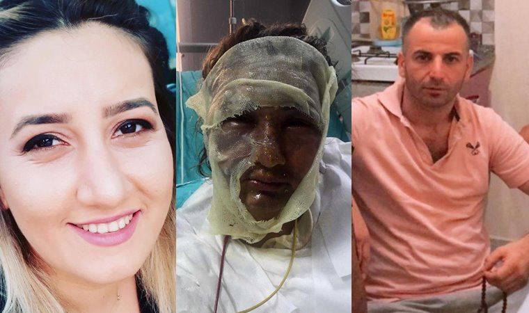 'Kızgın yağla yüzümü yaktı!' demişti, duruşmada inkar etti