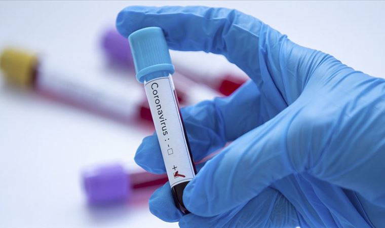 KKTC'de bir Alman kadın turistte koronavirüs tespit edildi