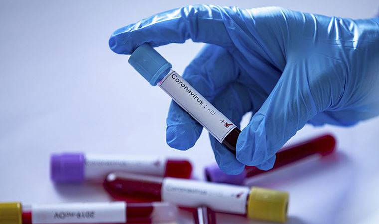 Özbekistan'da ilk koronavirüs vakası tespit edildi