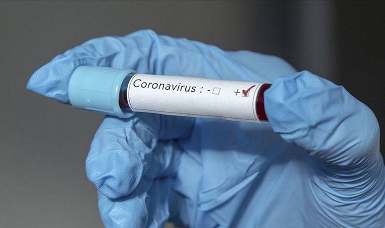 Prof. Dr. Aydın'dan, koronvirüsten korunmak için sıtma ilacı kullananlara önemli uyarı