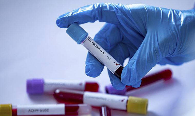 Dünya genelinde koronavirüsten yaşamını yitirenlerin sayısı 20 bini aştı