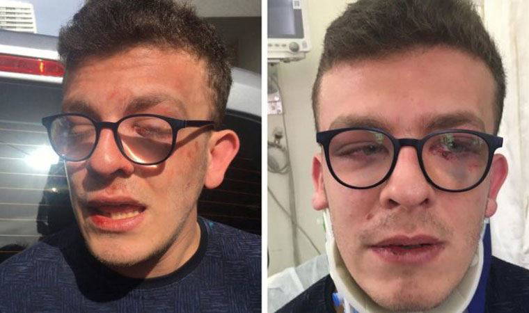 'Ben engelliyim, vurma' demesine rağmen otizmli genci darp eden saldırgan, serbest bırakıldı