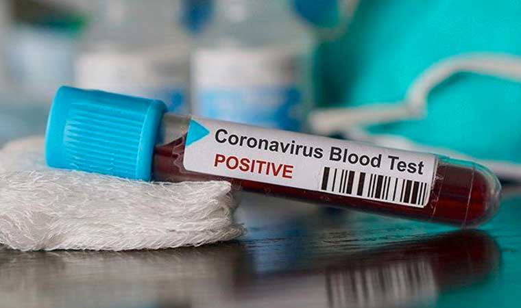 İYİ Parti'li Çıray'dan Sağlık Bakanı'na çağrı: Test kitini derhal iyileştirin