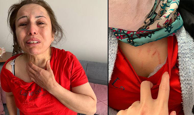 Bu çağrı duyulacak mı?: 'Yardım edin, dayanacak gücüm kalmadı!'