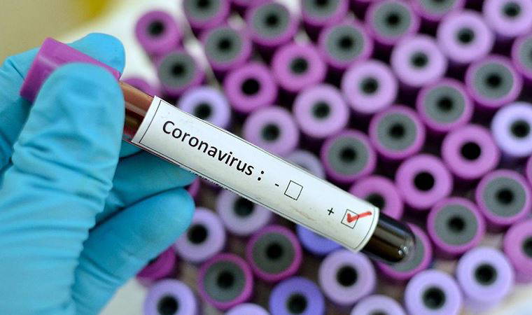 Amasya'da büyük skandal! Testi pozitif çıkan sağlık emekçisi zorla çalıştırıldı