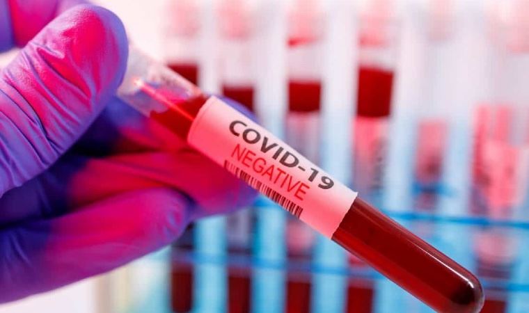 Mevlide katılan 37 kişi koronavirüse yakalandı