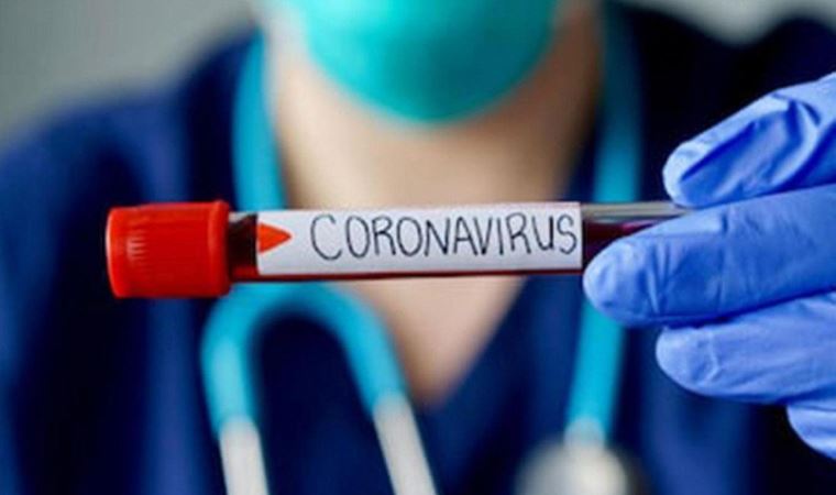 4 ülkeden  aşı için 750 milyon Avro ödeme
