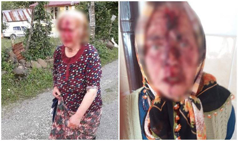 Tartıştığı yengesini baltayla başından yaraladı