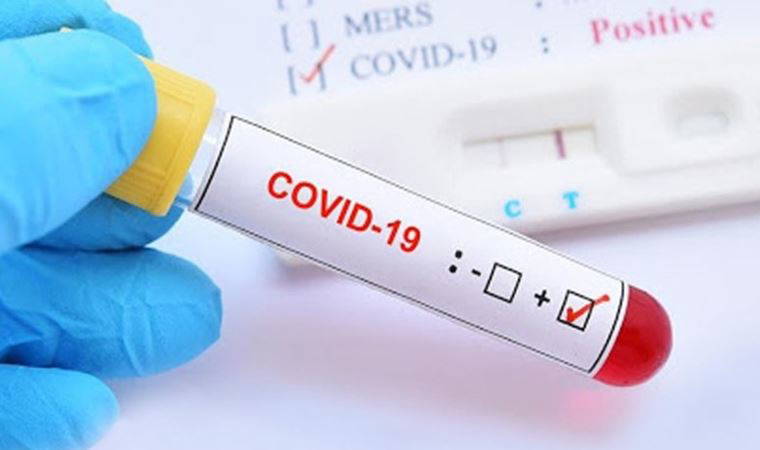 Dikkat! Kırmızı deri döküntüleri koronavirüs belirtisi olabilir