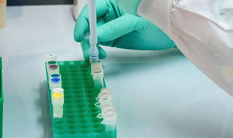 İspanyol doktorlar hastaların bile fark etmediği bir Covid-19 semptomu keşfetti