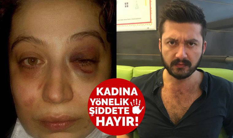 Eski eşinin şiddetine maruz kalan kadın: Can güvenliğim yok!