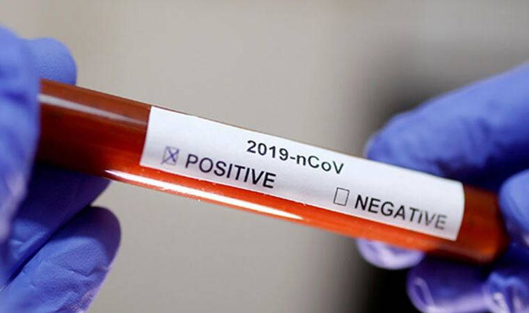 Bilim Kurulu Üyesi Öztürk: Eldiven kullanımının faydası değil, zararı olur