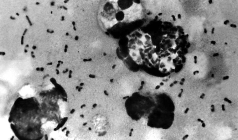 Çin'de hıyarcıklı veba ortaya çıktı