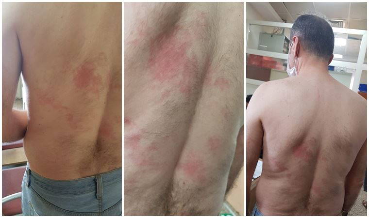 Engelli öğretmen sıcak çay fırlatan okul müdüründen şikayetçi oldu