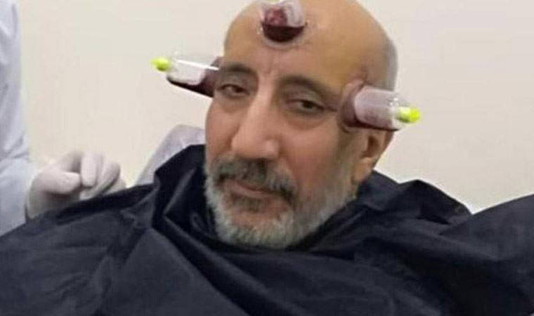 Tartışma büyüyor... Dilipak bu kez 'Sorosçu' dedi