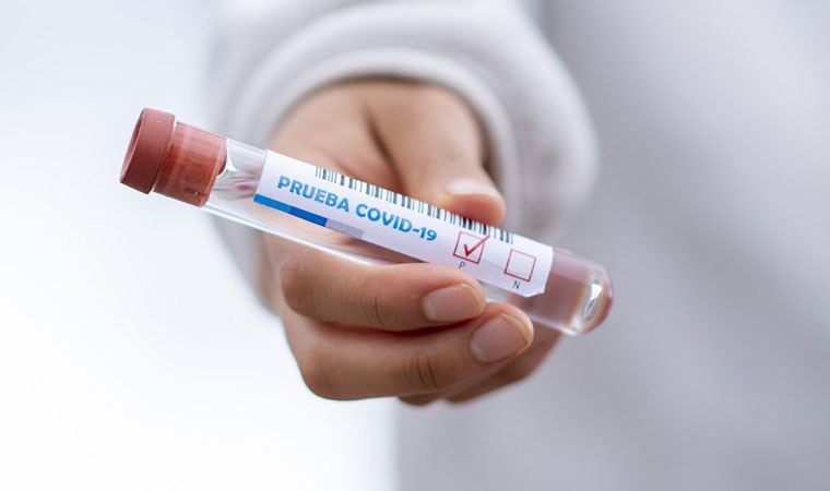 7 pozitif vaka çıktı, 578 kişi karantinaya alındı