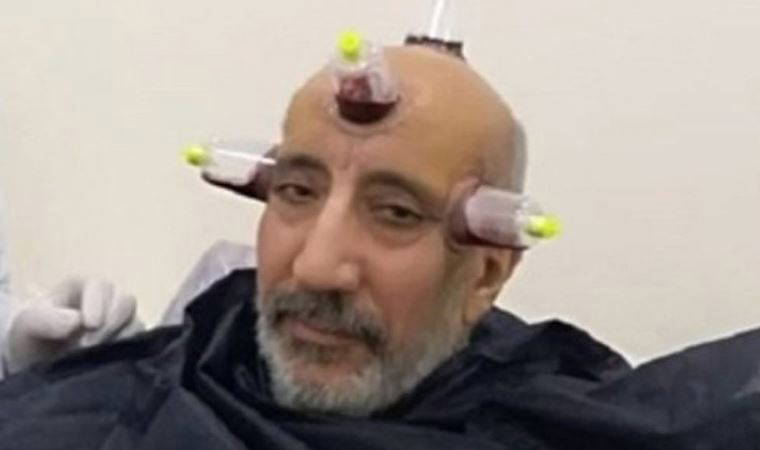 Dilipak'tan skandal 'fahişe' sözlerine savunma: Ak Parti değil AKP dedim