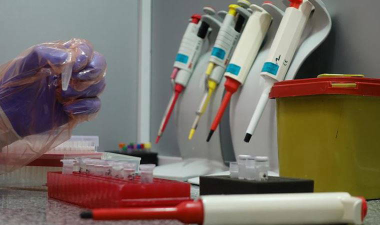 Ankara'da kaçak Covid-19 test kiti ele geçirildi