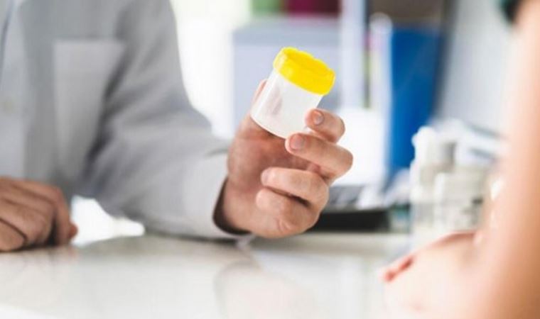 Koronavirüsü idrardan tespit edecekler