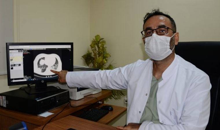 Doktor Hakan Akelma yoğun bakımda