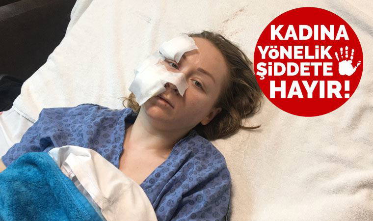 Boşanmak istediği Mesut Öztürkmen'in falçatalı saldırısına uğradı: 'Hapse kapatılmasını çok istiyorum'