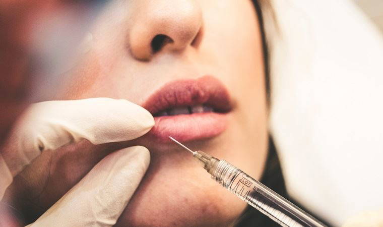 Ameliyatsız estetik: Dolgu nedir?