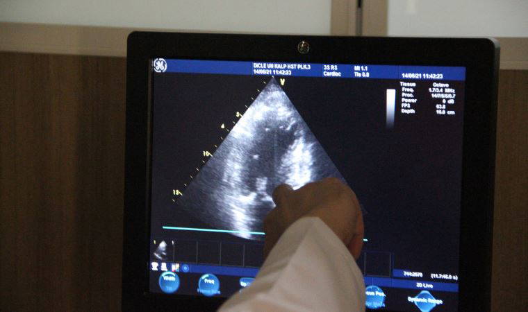 Koronavirüs geçirenlere kritik uyarı: 'Kalp damar uzmanlarına görünmesinde fayda var'