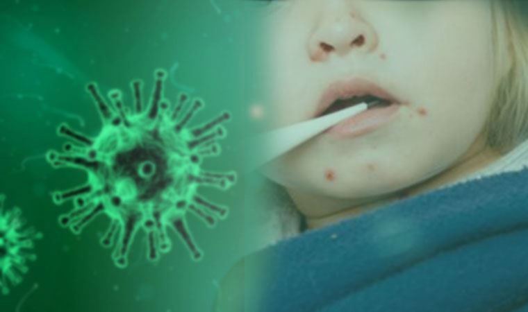 DSÖ: Covid-19, kızamıkla mücadeleyi sekteye uğratabilir