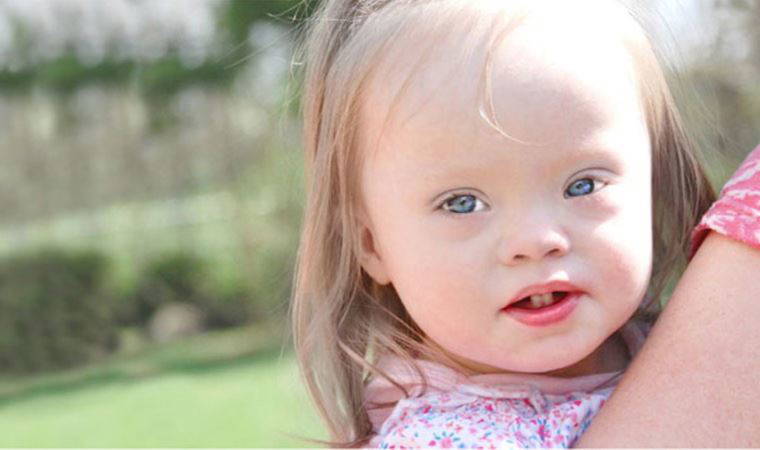 Yargıtay'dan down sendromlu çocukların ailelerini yakından ilgilendiren karar