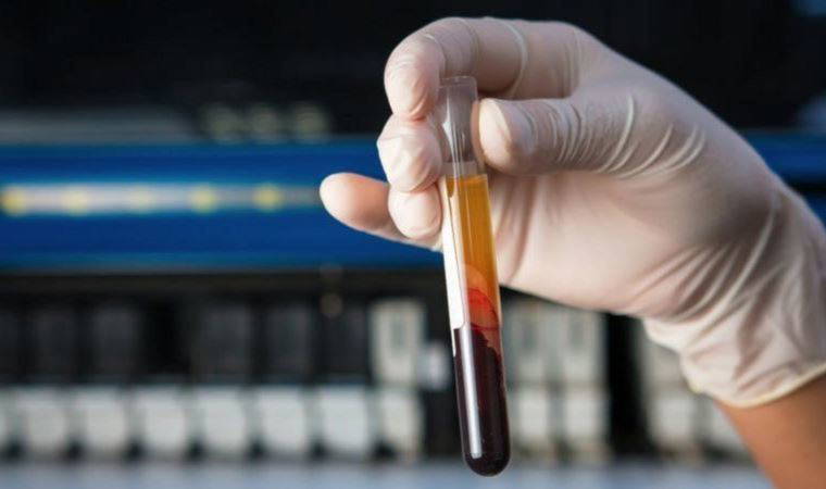 Bilim insanlarından çarpıcı araştırma: 50'den fazla kanser türünü tespit edebilir