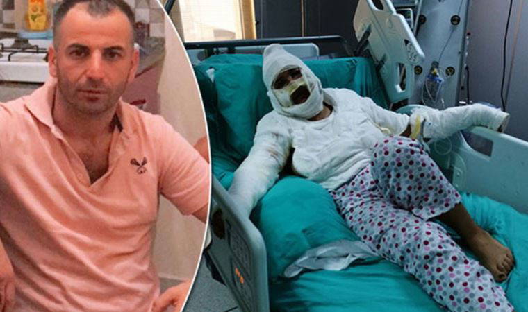 Karar mahkemeden dönmüştü; sevgilisine kızgın yağ döken sanığa yeniden 14 yıl hapis