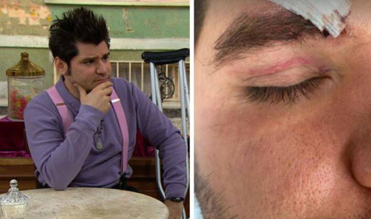 Saldırıya uğramıştı: Ceyhun Fersoy yaşananları ilk kez anlattı