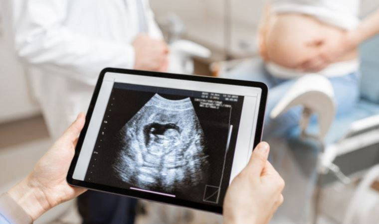 Japon doktorlardan 'fetal tedavi': Anne karnındaki bebek kalp ameliyatı oldu