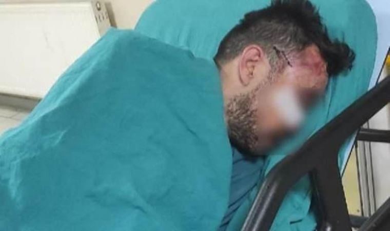 Üniversiteliye taciz girişimine tekme tokat dayak