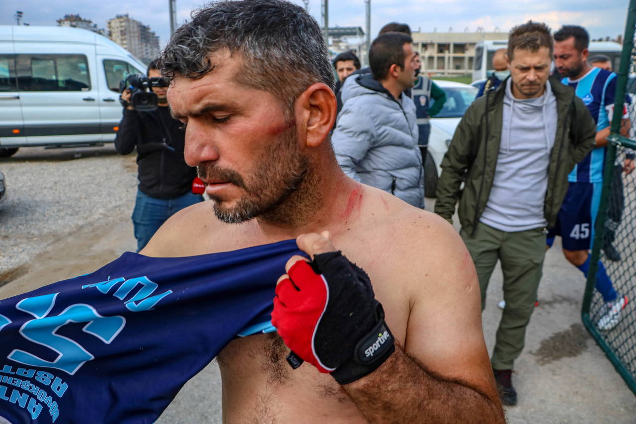 Ampute Ligi maçında yumruklar havada uçuştu