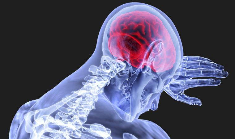 Beyin ve Sinir Cerrahisi Uzmanı uyardı: 'Covid-19 hastalarında, felç ve inme riski 7,5 kat artıyor'