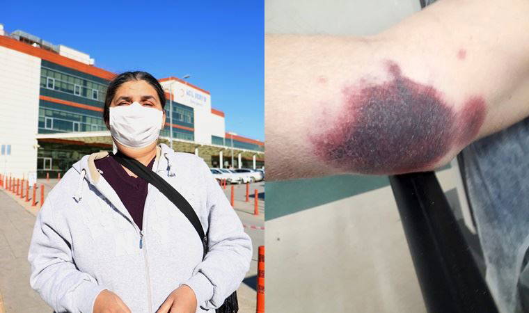 Engelli adam ile ailesini dövüp, tehdit ettiler