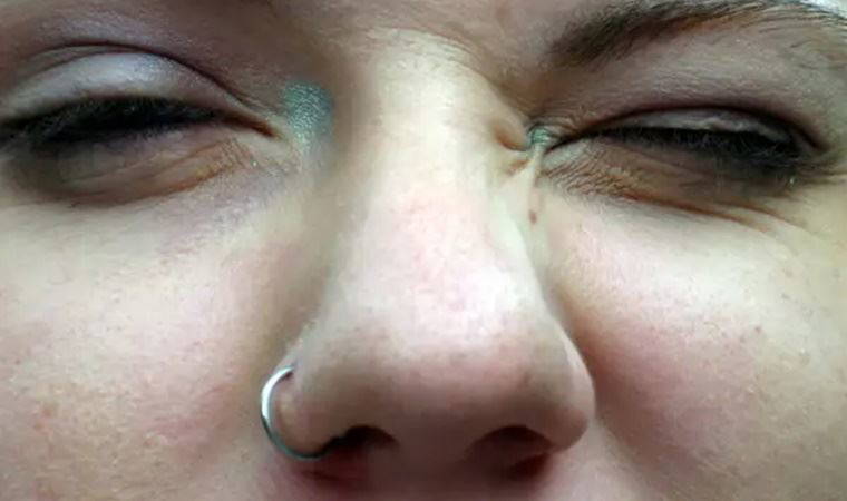 ABD'de burun piercing’i taktıran kadın ölümden döndü karaciğer nakli sayesinde hayata tutundu