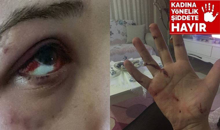 Karabük'te avukattan genç kadına şiddet!