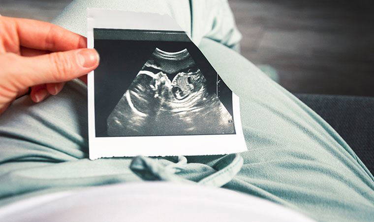 Genetik hastalıklar anne karnında bir kan testiyle belirlenebiliyor