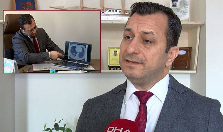 Koronavirüs hastalarında yüzde 30 oranında baş ağrısı tespit edildi