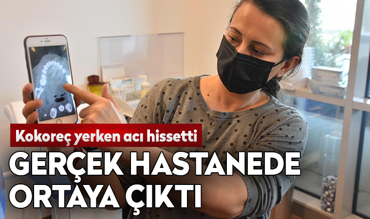 Kokoreç yerken acı hissetti, gerçek hastanede ortaya çıktı