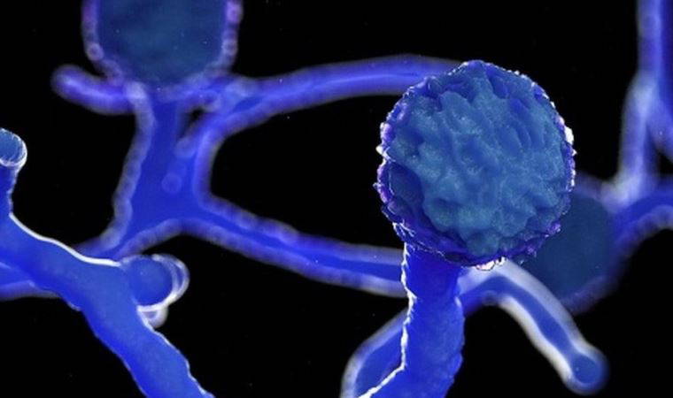 Hindistan'da Covid: Bazı hastalar ‘kara mantar’ nedeniyle görme yetilerini kaybediyor