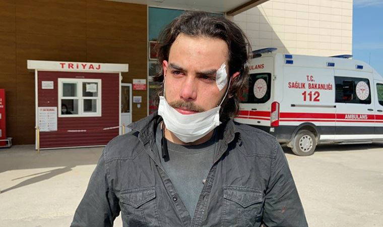 Suriyeli işçi ödenmeyen maaşını istedi, patronu tarafından darbedildi